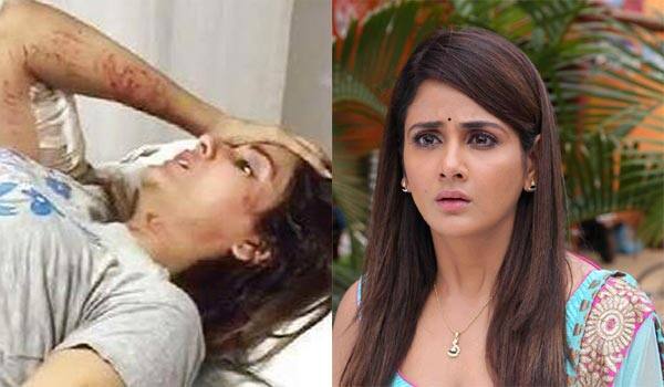 actress-parul-yadav-was-attacked-by-street-dogs