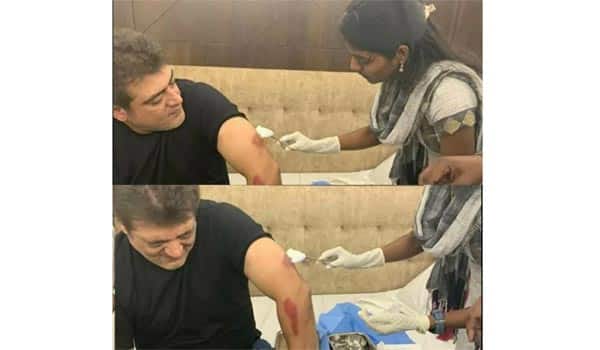 Ajith-injured-photo-goes-viral