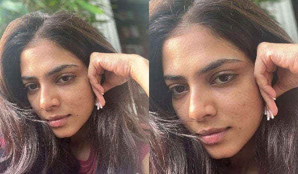 Malavika-mohanan-shares-about-her-pimples