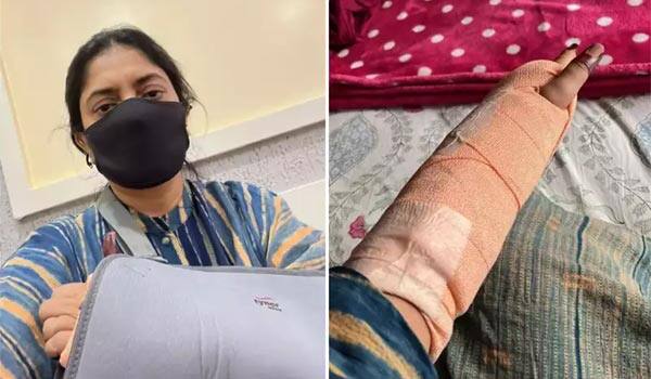 Director-Sudha-Kongara-injured;-fractures-hand
